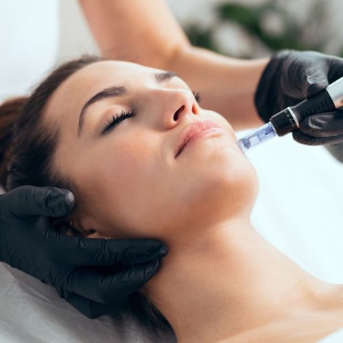 Microneedling